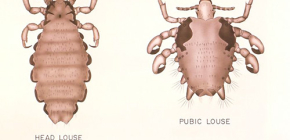 Butiran tentang kutu pada manusia