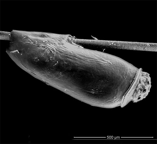 Kutu betina sangat kuat melekatkan nit pada rambut dengan rahsia melekit khas.