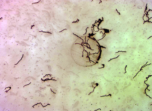 Borrelia burgdorferi تحت المجهر (بتكبير 400x).