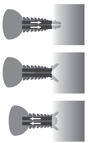 Gambar secara skematik menunjukkan bagaimana bahagian mulut kutu masuk ke dalam kulit apabila digigit.