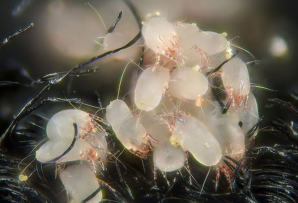 Hama habuk Dermatophagoides pteronyssinus hampir mustahil untuk dilihat dengan mata kasar di dalam permaidani, itulah sebabnya kebanyakan orang menganggap bahawa mereka tidak berada di dalam rumah.