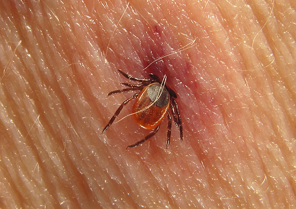 Ensefalitis bawaan kutu dan Lyme borreliosis selalunya membawa kepada ketidakupayaan seseorang yang sakit.