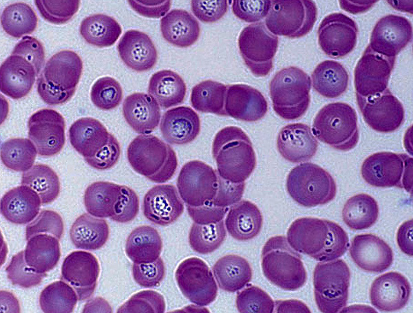 هكذا يبدو دم الكلب المصاب بداء البيروبلازما تحت المجهر - يمكن رؤية البيروبلازم بوضوح في خلايا الدم الحمراء.