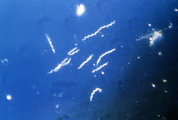 Borrelia burgdorferi