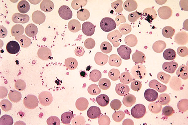 Piroplasmosis dalam darah
